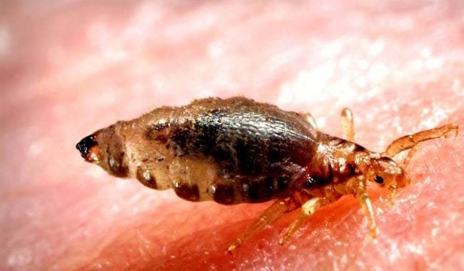 peste-nera-furono-i-pidocchi