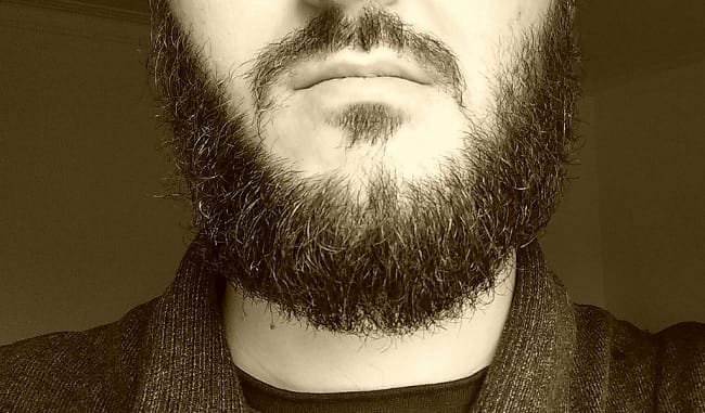Batteri molto piu numerosi nella barba che nel pelo di cani e gatti