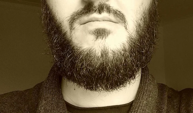 Batteri, molto più numerosi nella barba che nel pelo di cani e gatti