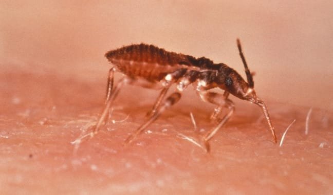 Malattia di Chagas attenzione anche alla cimice come vettore