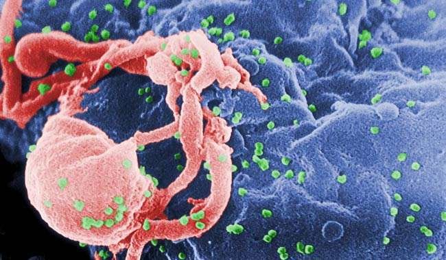 Aids-combattere-per-riuscire-a-sradicare-il-virus