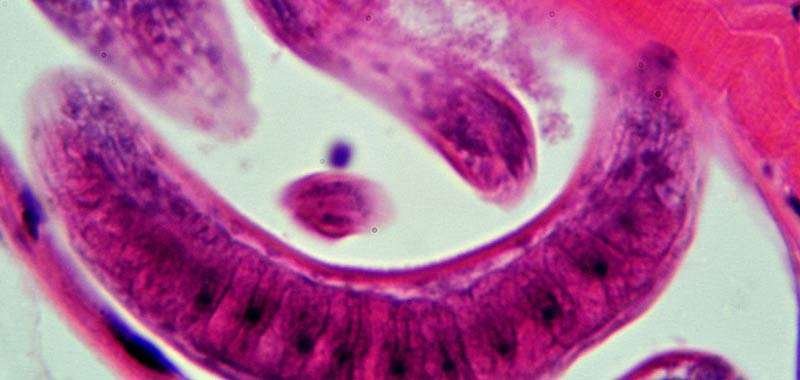 Dopo-tre-decenni-torna-la-trichinella-in-Italia