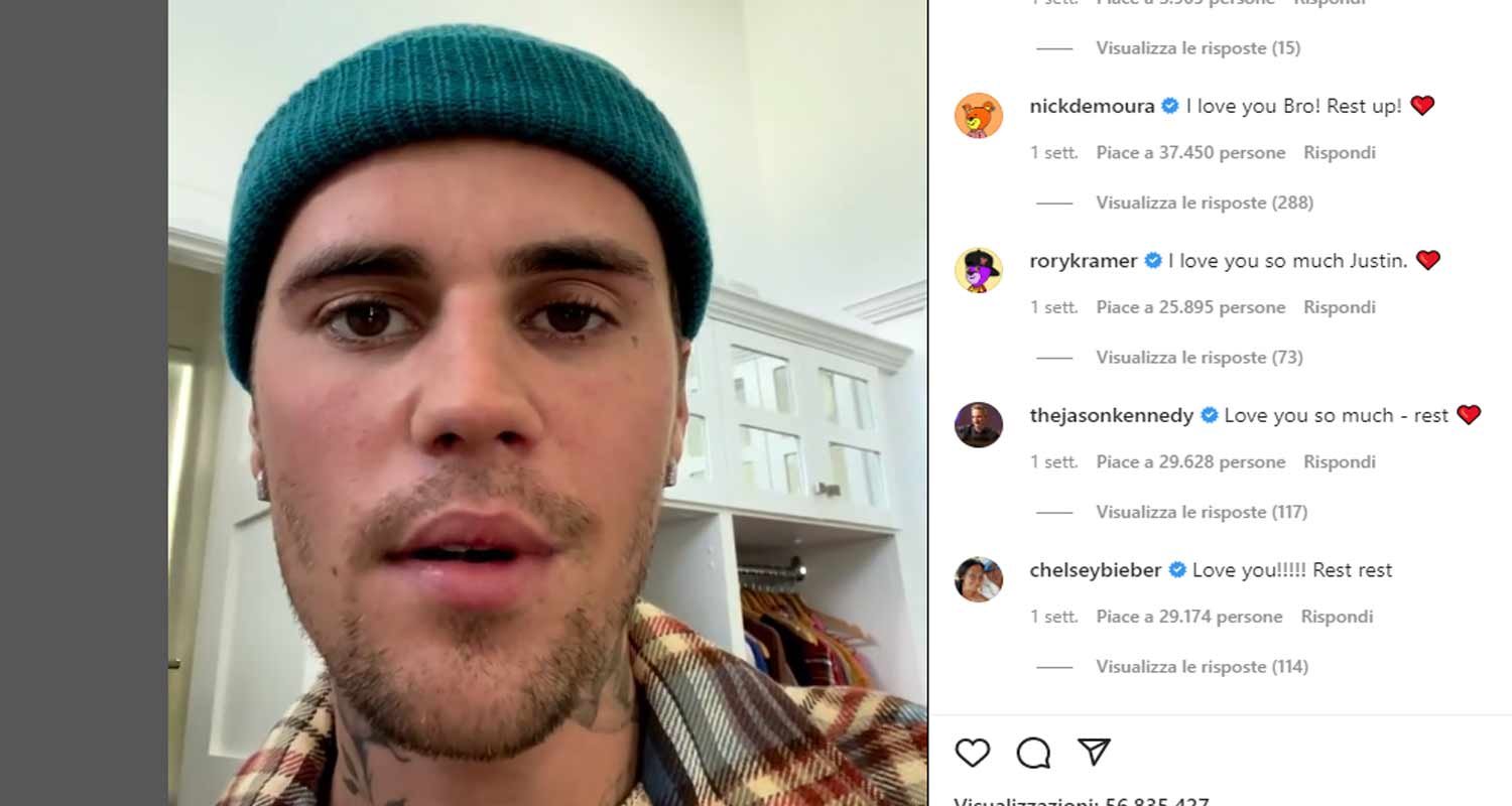 Ho la sindrome di Ramsay Hunt la rivelazione di Justin Bieber