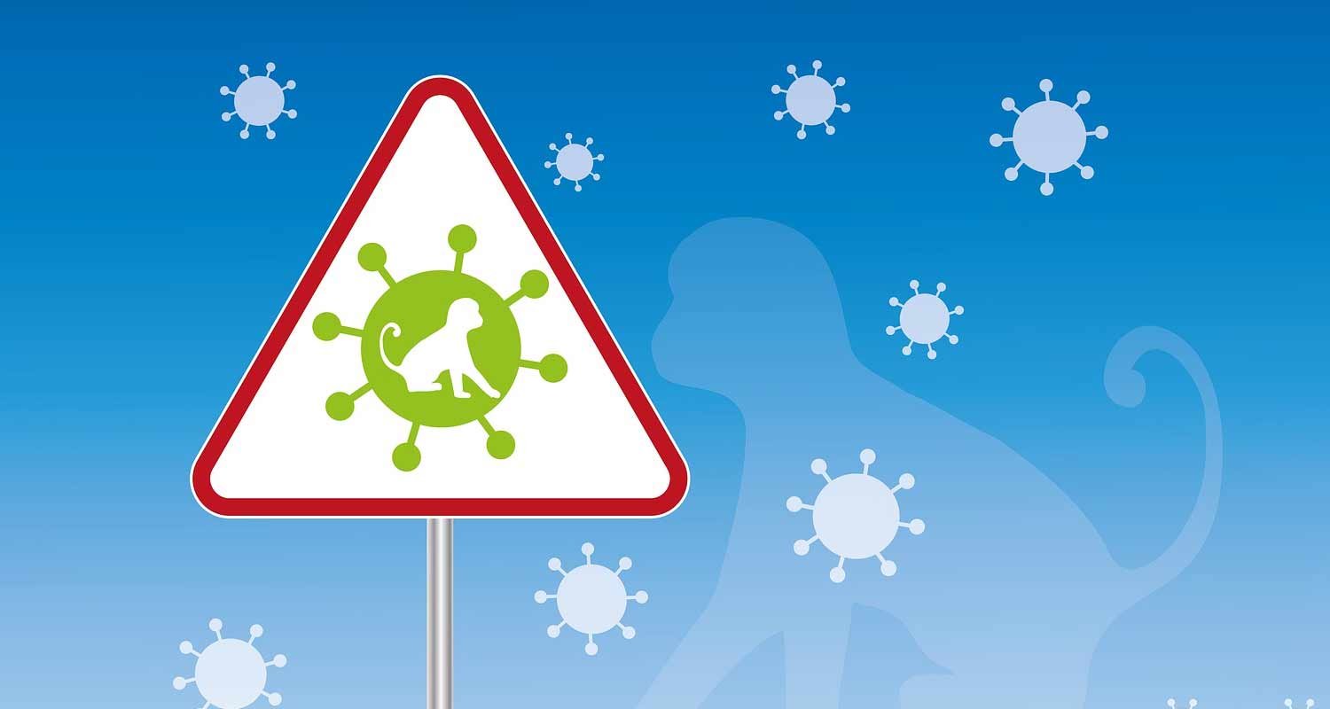 Monkeypox il vaiolo delle scimmie non è un’ergemenza