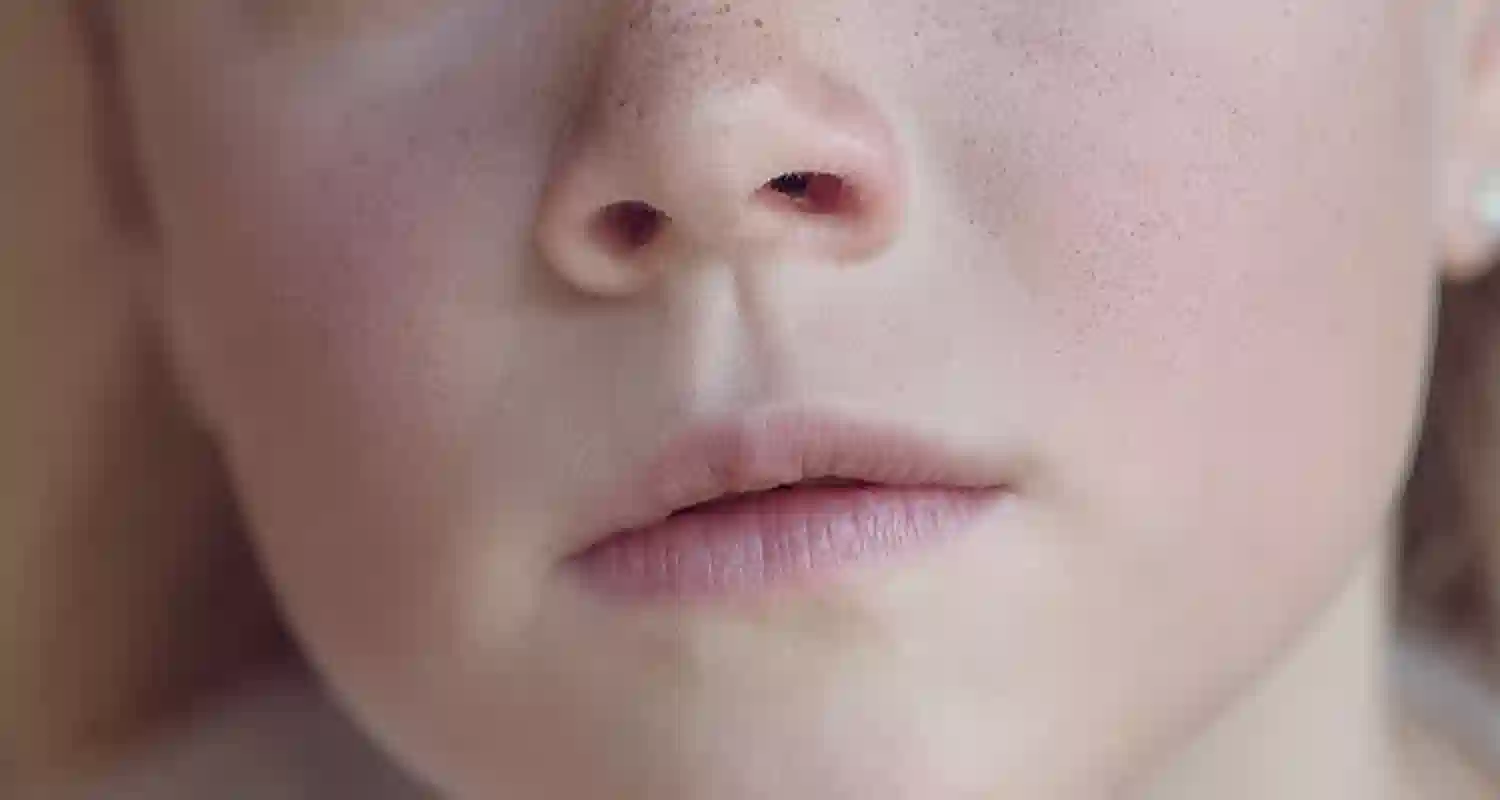Necrosi nasale attenzione a strappare i peli del naso